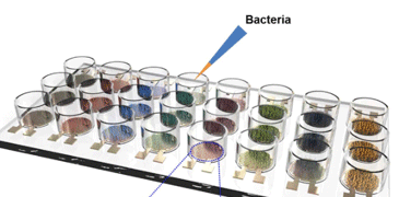 New method for rapid identification of bacteria promises to improve treatment
